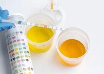Por qué el color de la orina es un indicador clave sobre la salud de una persona