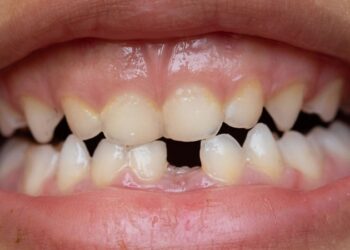 El primer fármaco del mundo para hacer crecer los dientes empezará a ensayarse este año