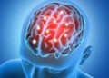 Estimulación cerebral es prometedora en el tratamiento de la adicción a las drogas