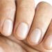 ¿Por qué no todos tenemos medialunas en las uñas?