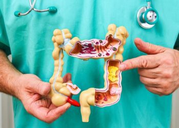 Este el posible ‘culpable’ del alarmante aumento de cáncer de colon en jóvenes