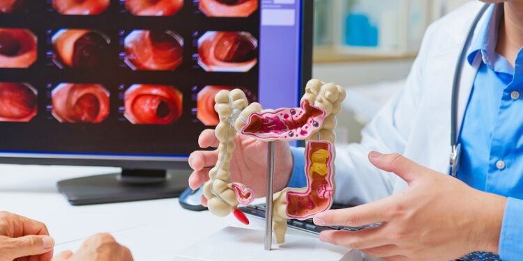 La pérdida de esta proteína podría provocar cáncer de colon