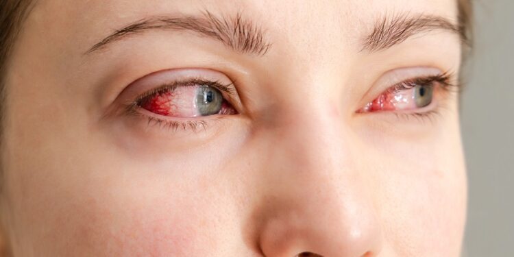 ¿Te arden los ojos? El polvo del Sahara y el calor podrían ser los culpables