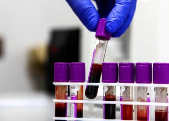 Inician en Rusia los primeros ensayos clínicos de una vacuna contra el cáncer