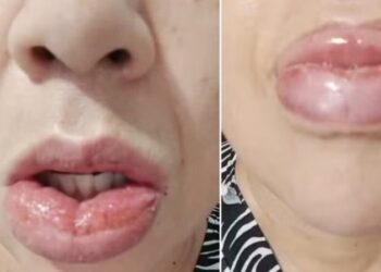 Dejarán de fabricar una conocida pasta dental después de miles de denuncias por reacciones adversas