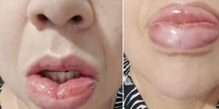 Dejarán de fabricar una conocida pasta dental después de miles de denuncias por reacciones adversas