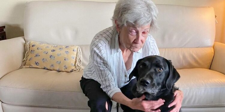 Mujer recupera la vista gracias a una inusual cirugía de diente en ojo