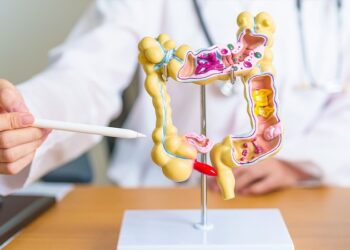 Estos simples hábitos ayudan a prevenir el cáncer de colon