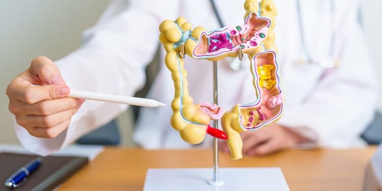 Estos simples hábitos ayudan a prevenir el cáncer de colon