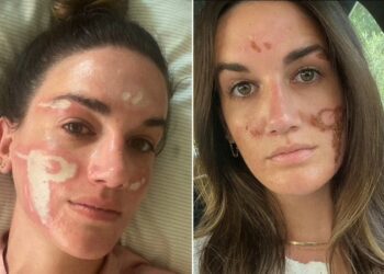 Denuncia a esteticista de famosos por haberle «desfigurado» el rostro de manera permanente