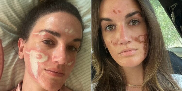 Denuncia a esteticista de famosos por haberle «desfigurado» el rostro de manera permanente