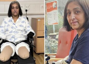 Una mujer pierde sus cuatro extremidades tras ser lamida por un perro