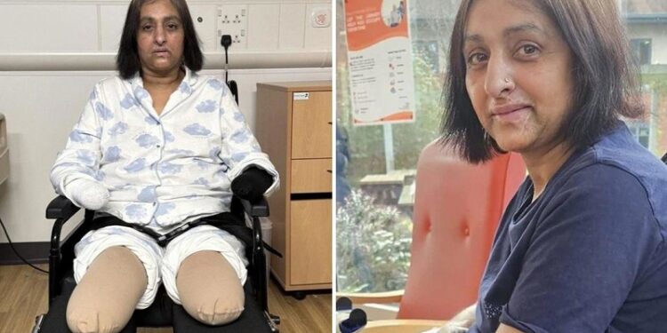 Una mujer pierde sus cuatro extremidades tras ser lamida por un perro