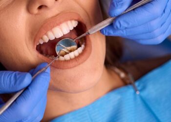 Este alimento cotidiano podría estar dañando tus dientes