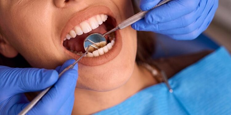 Este alimento cotidiano podría estar dañando tus dientes