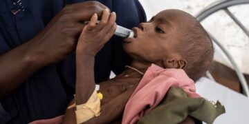 El hambre en el mundo se concentra en solo diez países