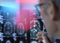 Tres alimentos que podrían blindar tu cerebro contra el alzheimer