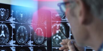 Tres alimentos que podrían blindar tu cerebro contra el alzheimer
