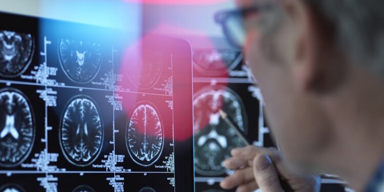 Tres alimentos que podrían blindar tu cerebro contra el alzheimer
