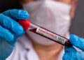 Identifican al ‘paciente cero’ de hantavirus y sus posibles causas de contagio