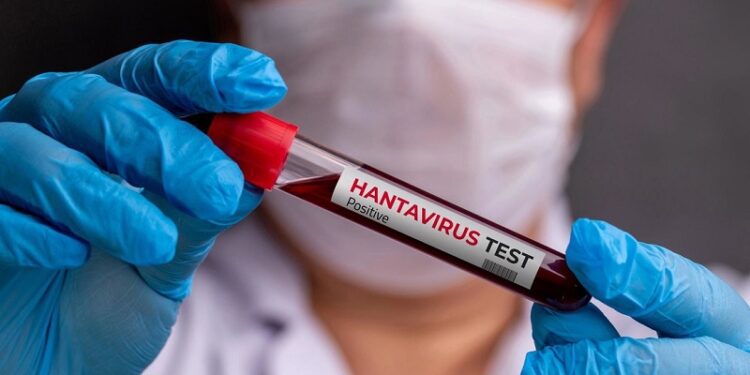 Identifican al ‘paciente cero’ de hantavirus y sus posibles causas de contagio
