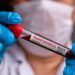 Identifican al ‘paciente cero’ de hantavirus y sus posibles causas de contagio