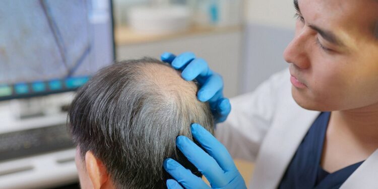 Cabello o vida: País asiático planea una controvertida adición a sus seguros de salud pública