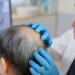 Cabello o vida: País asiático planea una controvertida adición a sus seguros de salud pública