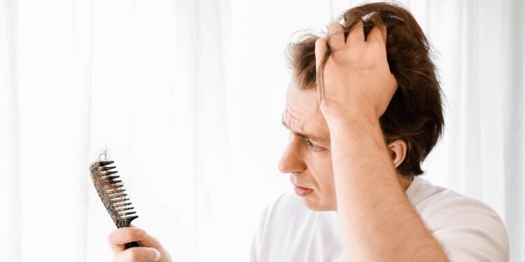 El uso de este tipo de fármacos podría aumentar el riesgo de pérdida de cabello en los hombres