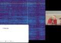 Paciente de Neuralink traduce sus pensamientos a voz por primera vez y esto fue lo que dijo (VIDEO)