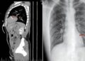 Acude al hospital por un dolor al orinar y los médicos encuentran algo inquietante en su cuerpo