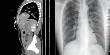 Acude al hospital por un dolor al orinar y los médicos encuentran algo inquietante en su cuerpo