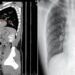Acude al hospital por un dolor al orinar y los médicos encuentran algo inquietante en su cuerpo