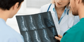 ¿Un tumor óseo siempre significa cáncer? Esto es lo que hay que saber