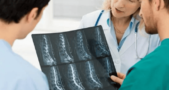 ¿Un tumor óseo siempre significa cáncer? Esto es lo que hay que saber