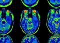 Científicos logran «leer» el cerebro y reconstruir lo que vemos
