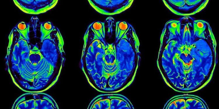 Científicos logran «leer» el cerebro y reconstruir lo que vemos