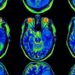 Científicos logran «leer» el cerebro y reconstruir lo que vemos