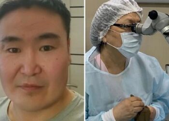 Extraen a un paciente una semilla que echó raíces en su ojo