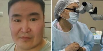 Extraen a un paciente una semilla que echó raíces en su ojo